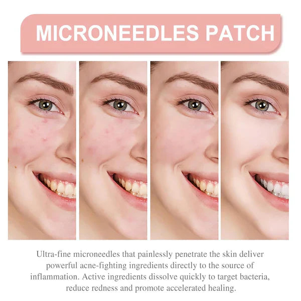 Derma Smooth Skin Tag Removal Patch