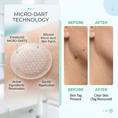 DermaSmooth - Tag & Mole Remover